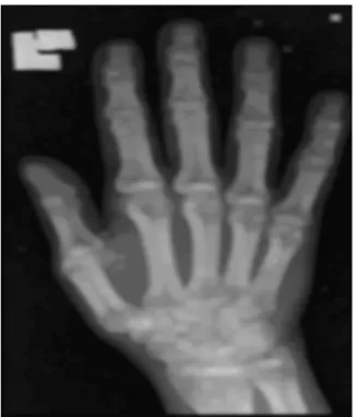 Fig -3 : Input image processed by a Gaussan filter. 