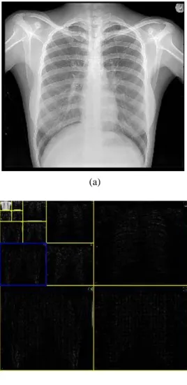 Figure 1. (a) Original X-ray image  (b) Four level decomposition of  the X-ray image. 