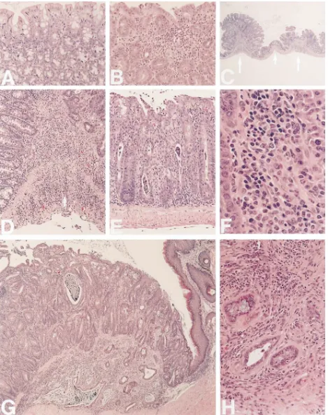 Figure 1. Histopathology of colonic changes in IL-10�/� mice. (A) Proximal colon from 3-wk-old wt mouse (150�)