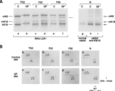 Figure 5. Biochemical analysis of liver keratins isolated from transgenic and nontransgenic mice fed control or griseofulvin diets for 17 d