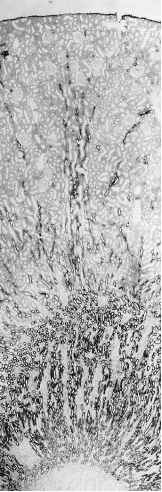 Figure 1. Expression of the furosemide/bumetanide sensitive Na-K-2Cl cotransporter (NKCC2) in rat kidney cortex: in situ hybridization with antisense DIG-labeled NKCC2 riboprobe