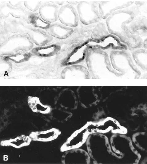 Figure 2. Expression of NKCC2 at higher resolution in rat (rabbit (A) and B) kidney cortex