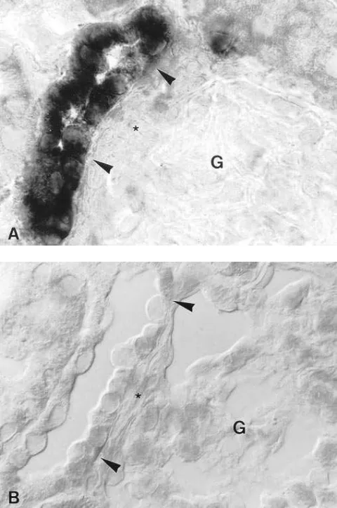Figure 5. Higher resolution of NKCC2 expression in rat macula densa analogous topography with typical macula densa cells adjacent to the extraglomerular mesangium (asterisks in Magnification (between arrowheads) by antisense in situ hybridization (A)