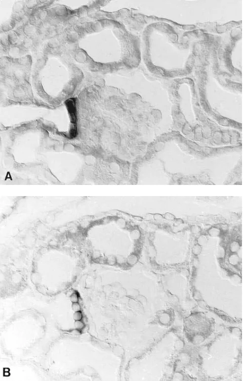 Figure 7. Labeling of the juxtaglomerular portion of TALH in rabbit NADPH-diaphorase staining (using in situ hybridization with NKCC2 antisense probe (A) and B) on consecutive sections