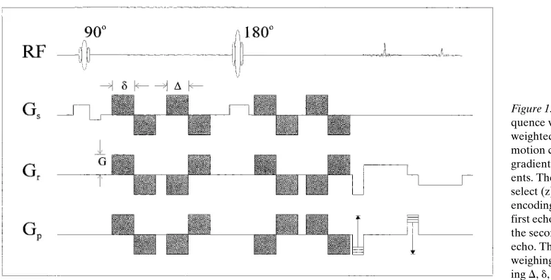 Figure 1. Spin-echo imaging se-