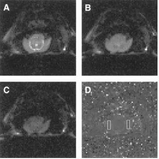 Table II. Effect of Hemodialysis on Apparent Diffusion Coefficient in Normal and Nephrectomized Rats