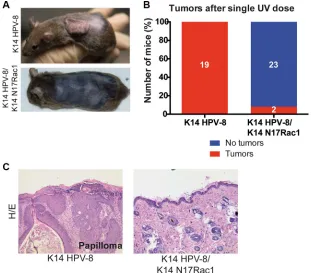 Figure 3: Epidermis specific inhibition of Rac1 attenuates UV-light induced skin tumor formation in K14 HPV-8 mice