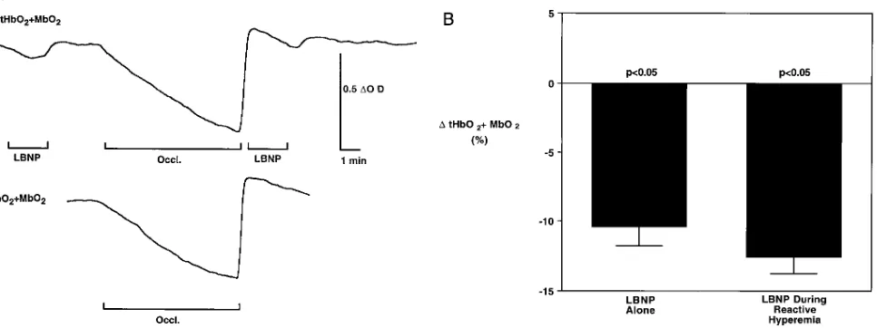 Figure 6. Summary data showing the effect of LBNP-induced re-these data, the threshold intensity of handgrip required to produce at 5, 10, and 20% MVC
