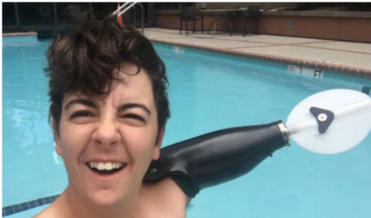 Figure 12 : Cassie using her Swimming Pin-Lock Prosthesis 