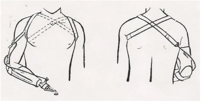 Figure 1: Figure 8 Harness for Upper-Limb Prosthesis [1] 