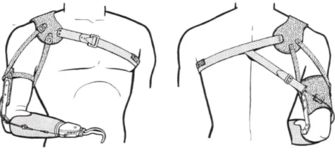 Figure 2: Chest Strap for Upper-Limb Prosthesis [1] 