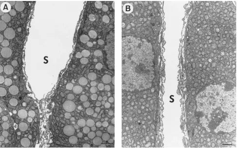 Figure 2. Electron micrographs of zona fasciculata cells from wild-type and apo A-I–deficient mice