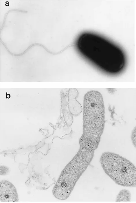 FIG. 2. Transmission electron microscopy of isolated bacteria showing onepolar ﬂagellum in negative staining (a) and electron-dense formations within the