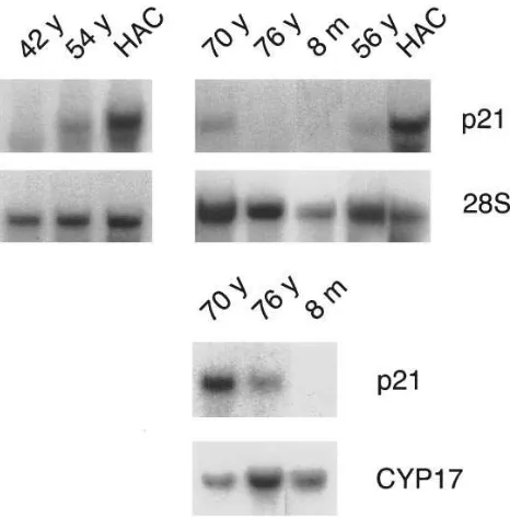 Figure 1. p21 mRNA levels in the human adrenal cortex. RNA was performed by rehybridization with probes for 28S ribosomal RNA or CYP17 (steroid 17mman adrenocortical cells (prepared from adrenal tissue from donors of the indicated ages (y, years; , months)