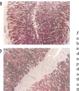 Figure 2. Patterns of p21 and p53 in a human adrenal photomicrographs (original magnification gland