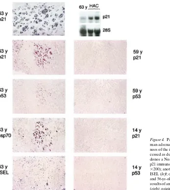 Figure 4. Patterns of p21, p53, hsp70, and ISEL in hu-�ISEL (and 56-yr-old donors, which did not show p21 mRNA, results of antibody staining for p21 and p53 are shown (p21 immunoreactivity (man adrenal glands