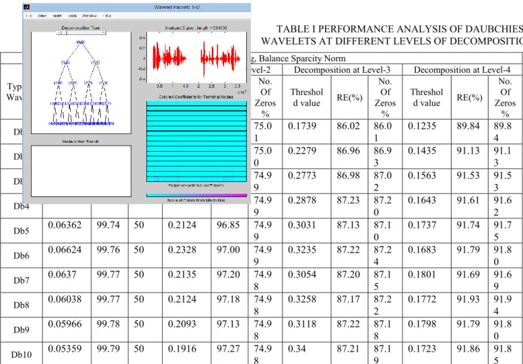 TABLE I PERFORMANCE ANALYSIS OF DAUBCHIES  WAVELETS AT DIFFERENT LEVELS OF DECOMPOSITIONS 