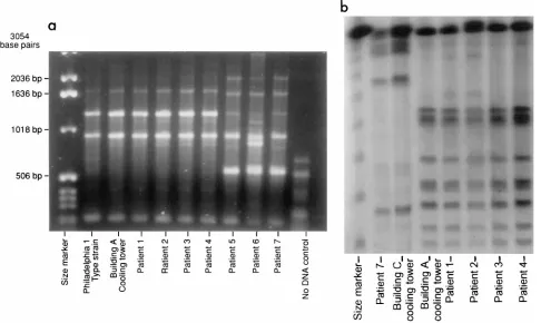 FIG. 3. AP-PCR analysis of patient isolates compared with isolate from cooling tower of building A (a) and PFGE analysis of matching patient and building Aisolates and two comparison strains (b)