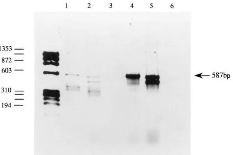 Figure 3. An ethidium bromide stained 3% agarose gel with �X-174/HaeIII size markers (in bp) showing the genomic DNA PCR product obtained with oligos 11A and 11B (exon 11) that has been digested with NlaIII