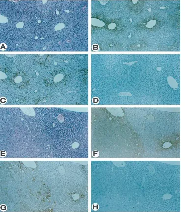 Figure 1. Multifocal areas of al-tered hepatocytes and benign tu-mor nodules in the liver of HBx-transgenic mice