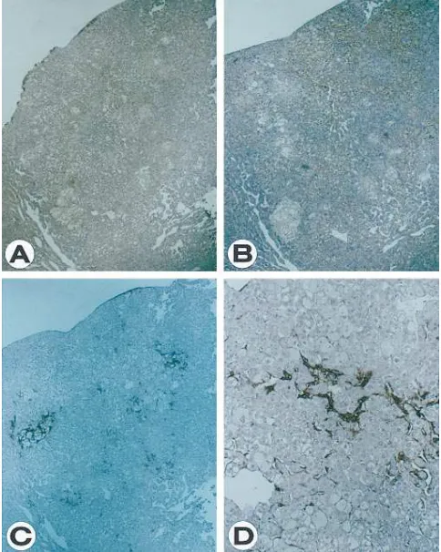 Figure 3. Northern blot 