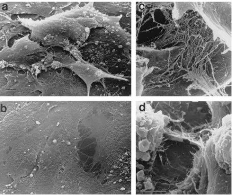 Figure 6. Steroid withdrawal–induced breakdown of human endometrial stromal cell cultures