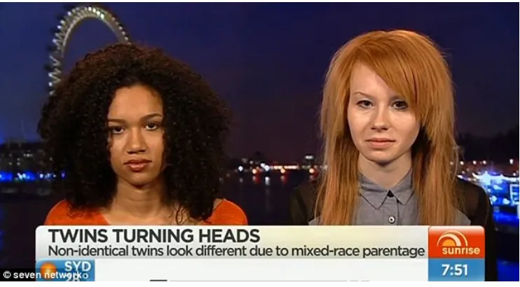 Figure 3. Difference visualized through coverage of mixed-race twins. 