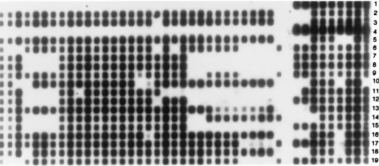 FIG. 1. Spoligotyping patterns of some of the isolates of M. tuberculosissequences which are found interspersed between the DRs in the analyzed in this study