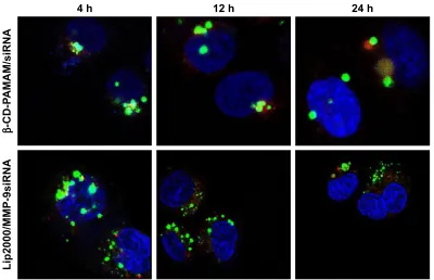 Figure 6 Uptake of polyplexes or liposomes was monitored by confocal microscopy.Notes: Photographs were taken at 4, 12, and 24 h after transfection
