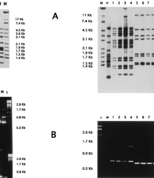 FIG. 3. Two sets of four different isolates showing identical banding patterns.The strains in lanes 1 to 4 are identical and those in lanes 5 to 8 are identical by