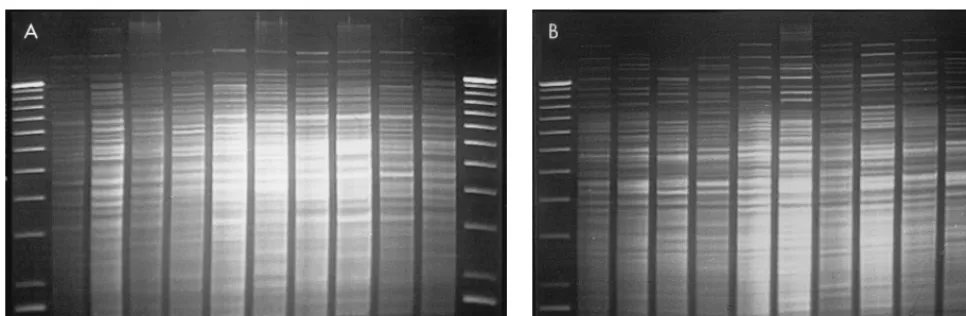 FIG. 2. Representative isolates of each type analyzed by PFGE. The lanes,from left to right, represent a 48.5-kb lambda DNA molecular weight ladder; a