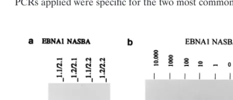 FIG. 2. (a) EBNA1 NASBA analysis of JY RNA with the four differentprimer combinations; combinations 1.1-2.1 and 1.2-2.1 clearly give stronger sig-