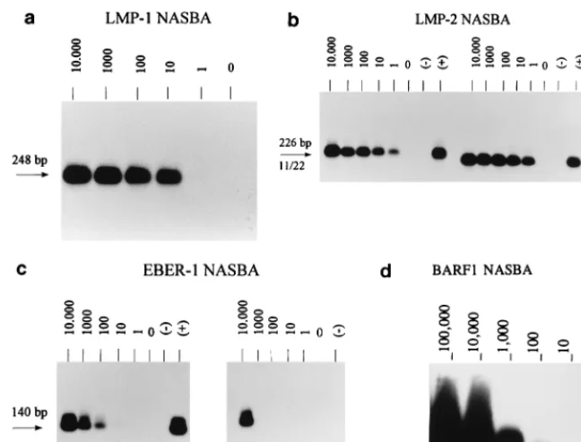 TABLE 3. Comparison of EBNA1 NASBA andRT-PCR on lymphoma material