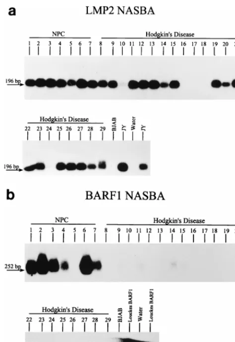 FIG. 4. Evaluation of the LMP2 (a) and BARF1 (b) NASBAs on NPC andHD samples. LMP2 signal is observed in all NPC cases and in 17 of 22 HD cases,
