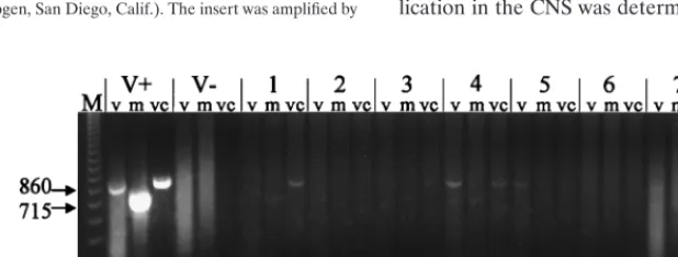 TABLE 1. Primers for RT-PCR of LAC virus S RNA