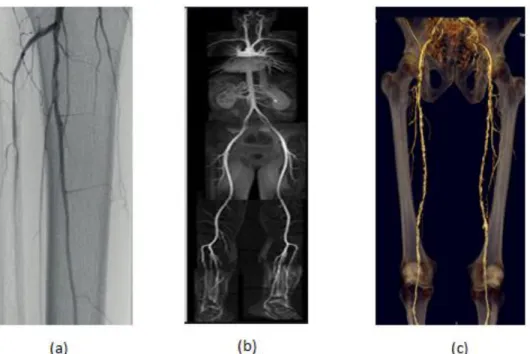 Figure 4: Evolution of imaging techniques  3.5 Clinical Management of PAD 