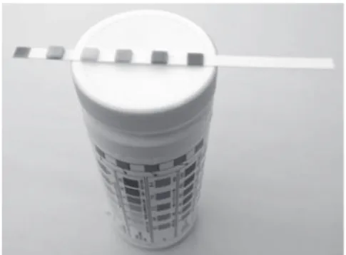 Figure 2.3  Dipstick device for analysis of water [18] 