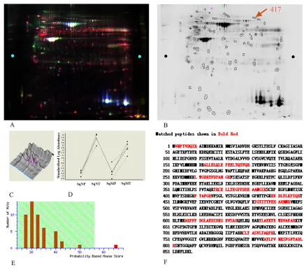 Figure 1: EF2 expression of LSCC tissues and peri-cacinoma lung tissues in 2-D DIGE and MS analysis