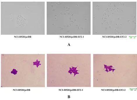 Figure 3: Cell morphology. A. Microscopy images under the phase contrast microscope. B