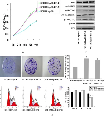 Figure 4: The effect of EF2 overexpression on cell proliferation of NCI- H520 in vitrosignificantly promoted the growth of NCI- H520/pcDB-EF2 cells