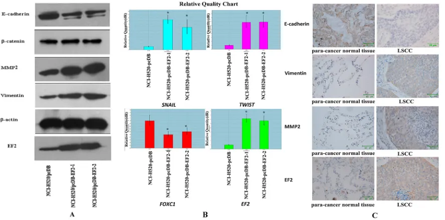 Figure 5: The effect of EF2 overexpression on cell migration and invasion. scratching, few cells migrated across the wound in the NCI-H520/pcDB cell groups compared with the NCI-H520/ pcDB-EF2 cell groups