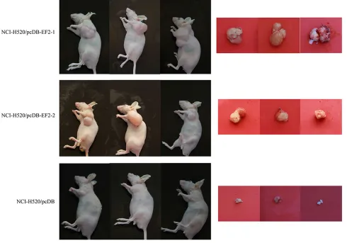 Figure 7: Overexpression of EF2 enhances the tumorigenicity of NCI-H520 cells. In nude mice, the NCI-H520/pcDB-EF2 cells grew larger tumors compared with the control group.