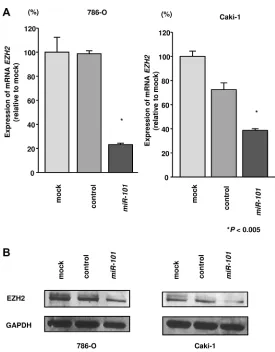 Figure 4: Effects of miR-101 transfection on EZH2 mRNA and protein expression in RCC cells