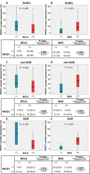 Figure 4: PAtZ1, bcL6 and bAX correlations in DLbcLs. Boxplot of DLBCL (A, b) and sub-types non-GCB (c, D) and GCB (E, F) cohorts: correlation between PATZ1 nuclear expression and BCL6 (A, C, E) and BAX (B, D, E) high (+) or absent/low (−) expression