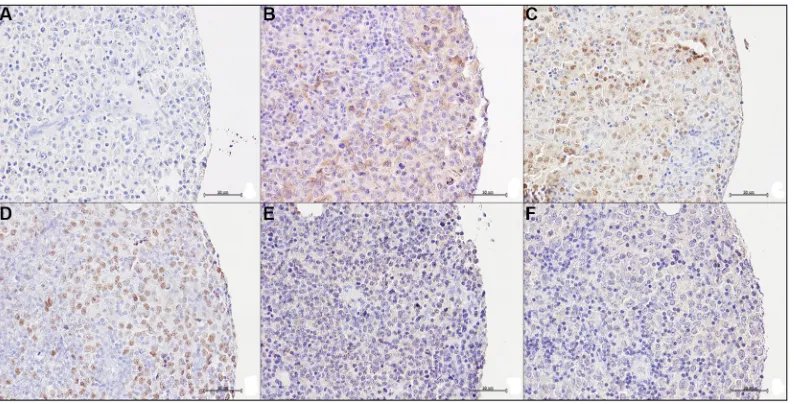 Figure 6: Bcl6 and Bax expression in Patz1-knockout mice. RT-qPCR showing expression of Patz1, Bcl6 and Bax genes in one healthy spleen (945PA) and two lymphomas (833PA, 800PA) from Patz1+/− mice in comparison with a normal spleen sample from a wild-type s