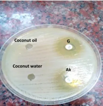 Figure 1: Gram negative bacilli with Amikacin(Ak) and Gentamicin(G) as control antibiotics along with Coconut water & Coconut oil