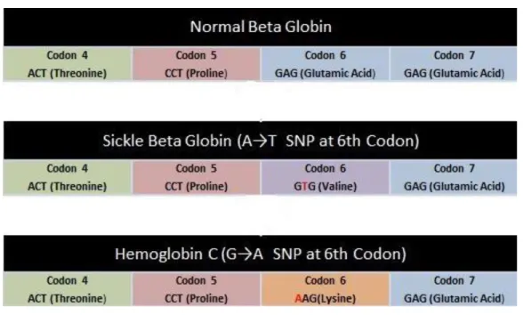 Figure 3:  Single nucleotide polymorphisms on 6 th  codon of beta globin gene 