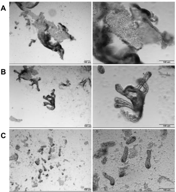 Figure  2.11  -  Epithelial  preparations  enrich  for  stem  cell  containing  crypts