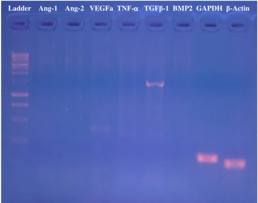 Figure 8 - PCR amplicons using cDNA reverse transcribed from RNA isolate 1B. 