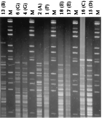 Fig. 2 to 5. Figure 2 showsThe results of the pattern recognition study are shown inelectrophoresis buffer can be judged by comparing this ﬁgurewith Fig